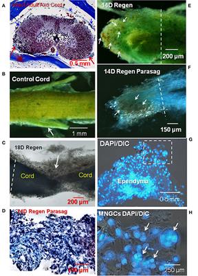 Meningeal Foam Cells and Ependymal Cells in Axolotl Spinal Cord Regeneration